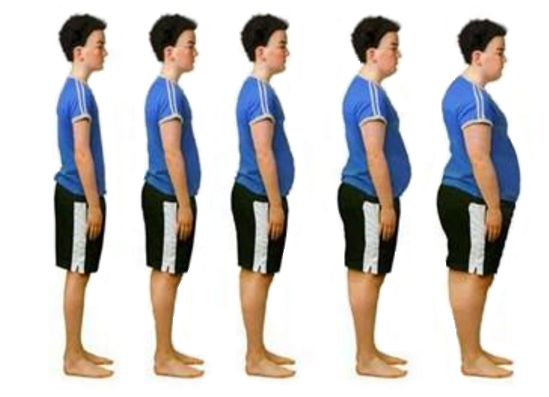 Evolução Postura Humana - Obesidade