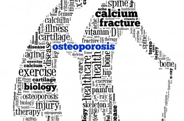 Osteoporose tem Cura? Veja como evitar esta doença.